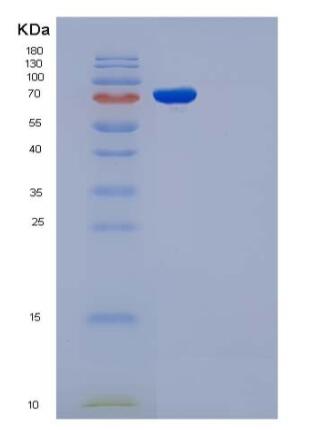 Recombinant Rat gp130 / IL6ST / CD130 Protein (His & Fc tag),Recombinant Rat gp130 / IL6ST / CD130 Protein (His & Fc tag)