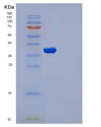 Recombinant Rat IL1R1 / CD121a Protein (His tag),Recombinant Rat IL1R1 / CD121a Protein (His tag)