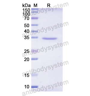 重組SERPINA7蛋白,Recombinant Human SERPINA7, N-His