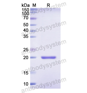 重组KRT18蛋白,Recombinant Human KRT18, N-His