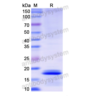 重组KRT8/CK-8,蛋白,Recombinant Human KRT8/CK-8, N-His