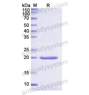 重组CSN2蛋白,Recombinant Human CSN2, N-His