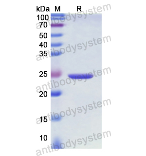 重组CD220/INSR蛋白,Recombinant Human CD220/INSR, N-His