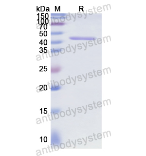 重組RB1蛋白,Recombinant Human RB1, N-GST