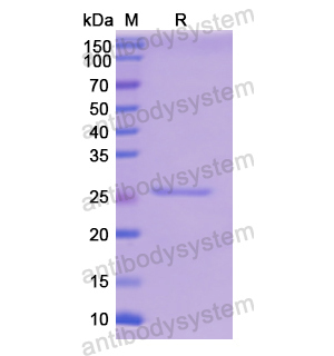 重組GPI蛋白,Recombinant Human GPI, N-His