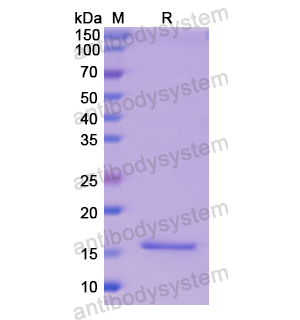 重组NPM1蛋白,Recombinant Human NPM1, N-His