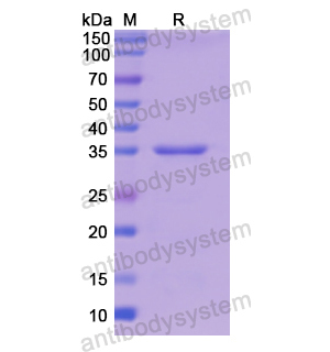 重组TPM3蛋白,Recombinant Human TPM3, N-His