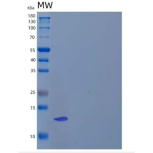 Recombinant Human S100 Calcium Binding Protein P/S100-P Protein(N-6His)