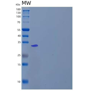 Recombinant Human Malate Dehydrogenase, Mitochondrial/MDH2 Protein(C-6His)