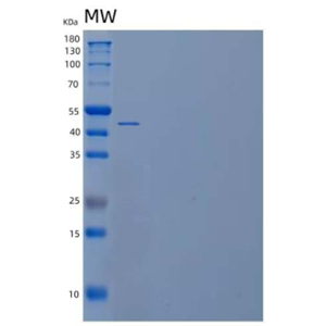 Recombinant Human Selenophosphate Synthase 1/SEPHS1 Protein(C-6His),Recombinant Human Selenophosphate Synthase 1/SEPHS1 Protein(C-6His)