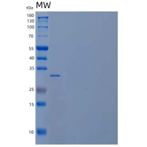 Recombinant Human Carbonic Anhydrase 14/CA14 Protein(N-6His)