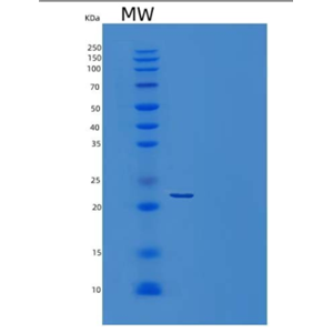 Recombinant Human Cardiotrophin-1/CTF1 Protein(N-6His)