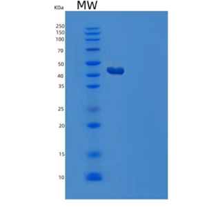 Recombinant Human Serpin A4/Kallistatin Protein(C-6His)