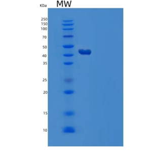 Recombinant Human Methyl-CpG-Binding Protein 2/MECP2 Protein(C-6His),Recombinant Human Methyl-CpG-Binding Protein 2/MECP2 Protein(C-6His)