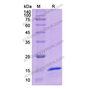 Recombinant Human IL5, N-His