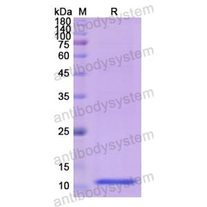 重組HMGN1蛋白,Recombinant Human HMGN1, N-His