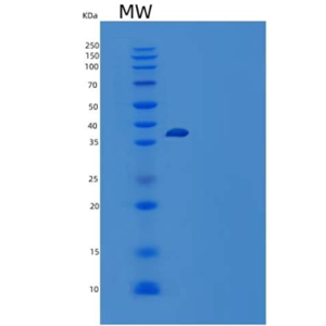 Recombinant Human Serpin Kazal-7/SPINK7/ECG2 Protein(C-6His)