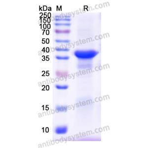 重組SERPINA5蛋白,Recombinant Human SERPINA5, N-His