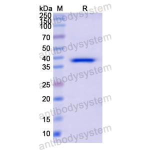 Recombinant Human CFI, N-His