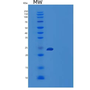 Recombinant Human Mucin-15/MUC15 Protein(C-6His),Recombinant Human Mucin-15/MUC15 Protein(C-6His)