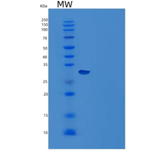 Recombinant Mouse Carbonic Ahydrase 14/CA14 Protein(N-6His)