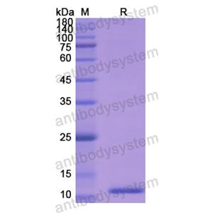 重组MPO蛋白,Recombinant Human MPO, N-His