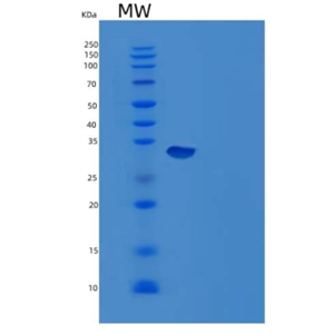 Recombinant Mouse Carbonic Anhydrase 12/CA12 Protein(C-6His)