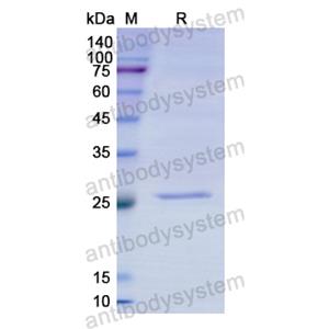 重組CYP1A2蛋白,Recombinant Human CYP1A2, N-His