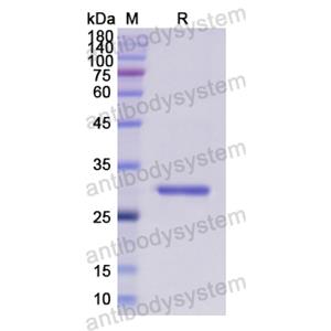 Recombinant Human EIF2S1, N-His