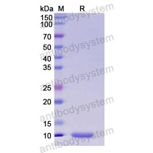 重組HMGN2蛋白,Recombinant Human HMGN2, N-His