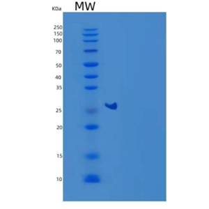 Recombinant Mouse Complement factor D Protein