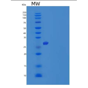 Recombinant Human Myozenin-2/MYOZ2 Protein(C-6His),Recombinant Human Myozenin-2/MYOZ2 Protein(C-6His)