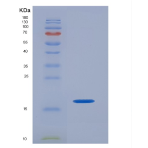 Recombinant Human ISG15 / G1P2 Protein