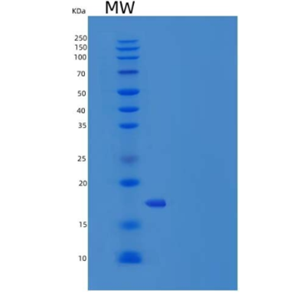 Recombinant Human IL7 / interleukin 7 Protein