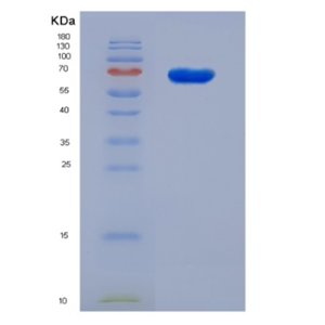 Recobinant Mouse IGFBP-2 / IGFBP2 Protein (Fc Tag)