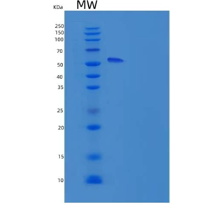 Recombinant Rat ICAM-1 / CD54 Protein (His tag)