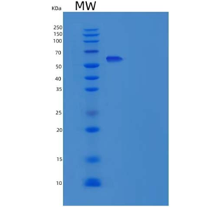 Recombinant Human RELA / Transcription factor p65 / NFkB p65 Protein (aa 1-306, GST tag)