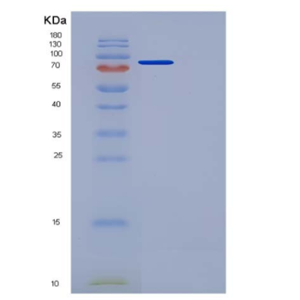 Recombinant Mouse Semaphorin 3A / SEMA3A Protein (Fc tag),Recombinant Mouse Semaphorin 3A / SEMA3A Protein (Fc tag)