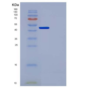 Recombinant Human Urokinase / uPA Protein (His Tag)