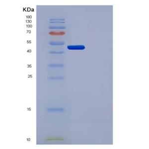 Recombinant Human Urokinase / PLAU Protein (His tag)