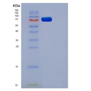 Recombinant Rat VEGFR1 / FLT-1 Protein (His tag),Recombinant Rat VEGFR1 / FLT-1 Protein (His tag)