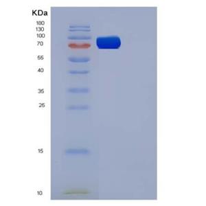 Recombinant Mouse VEGFR3 / FLT-4 Protein (His tag)