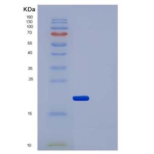 Recombinant Human IL2Ra / CD25 Protein (His tag)