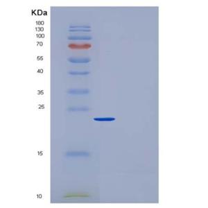 Recombinant Rat CRP / C-Reactive Protein (His tag)