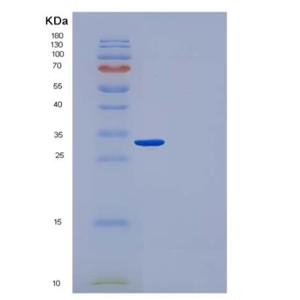 Recombinant Human CUTC / CGI-32 Protein (His tag)