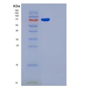 Recombinant Rat gp130 / IL6ST / CD130 Protein (His & Fc tag)