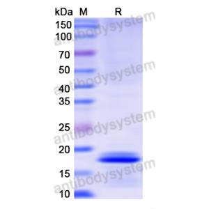 Recombinant Human KRT8/CK-8, N-His