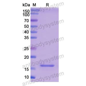 Recombinant Human MYL1, N-His