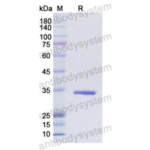 Recombinant Human CD1A, N-His