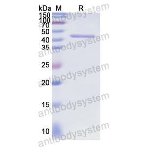 Recombinant Human RB1, N-GST